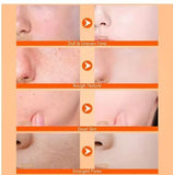 Exfoliating Kojic Acid Turmeric Spray 400 ml Pack of 2